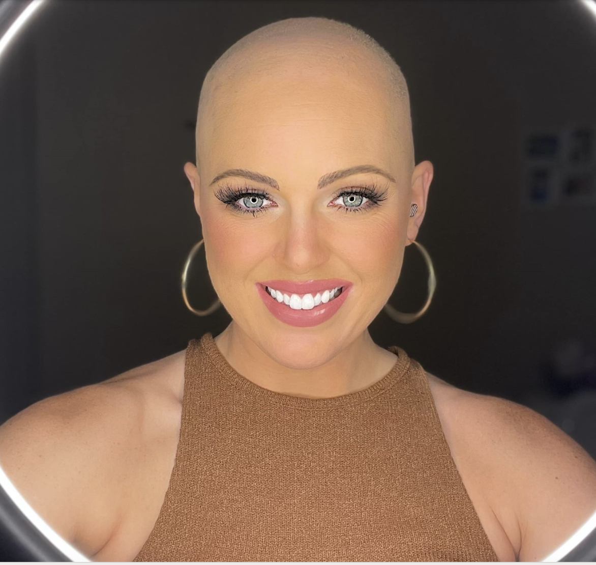 Brittany Foxworth National Alopecia Areata Foundation NAAF